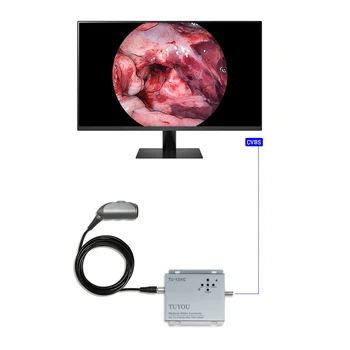 Портативный медицинский эндоскопический видео конвертер 1080P Full HD для хирургического аппарата для лапароскопической диагностики ЛОР-органов